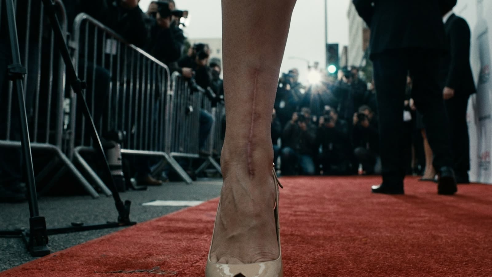 Hollywood's injury industrial complex is thriving. The famous have learned that a good scar tells a better story than a good publicist.